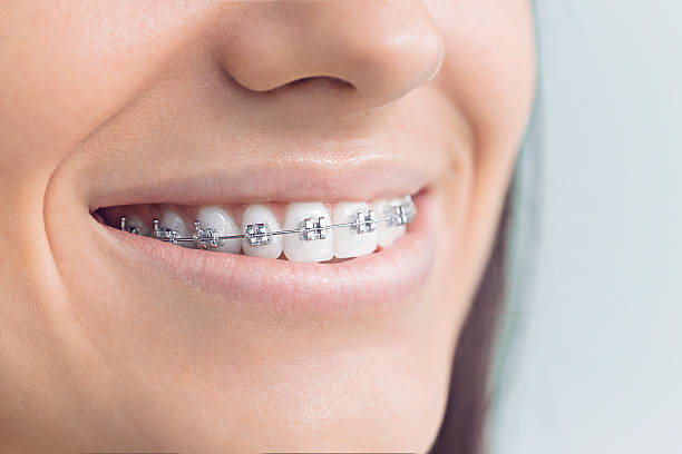 Best Veneers and Lumineers  in Prichard, AL